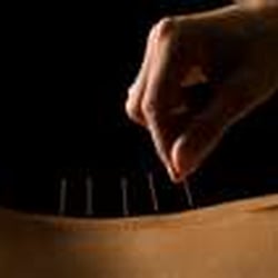 Seven Oaks Wellness Center - Acupuncture