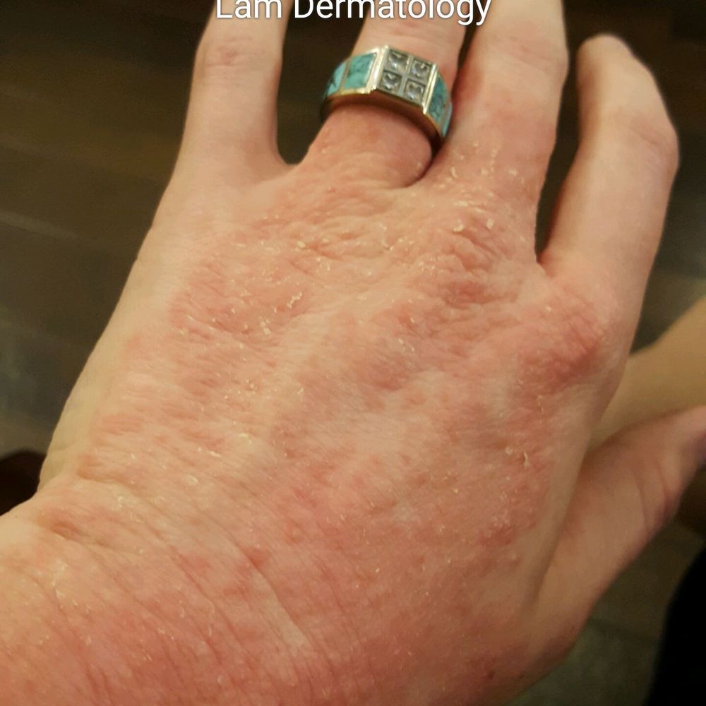 Lam Dermatology - The day of my appointment - Dermatologists Near Me - Oklahoma City, Oklahoma Lam Dermatology - The day of my appointment - Dermatologists Near Me - Oklahoma City, Oklahoma