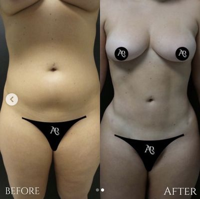 Aristocrat Plastic Surgery & MedAesthetics