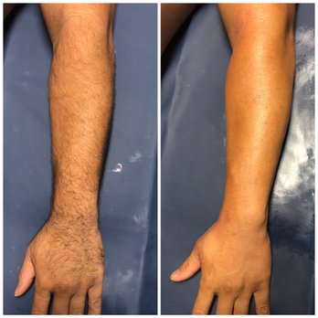 Saltwater and Skin - Arm Waxing. - Skin Care Near Me Saltwater and Skin - Arm Waxing. - Skin Care Near Me