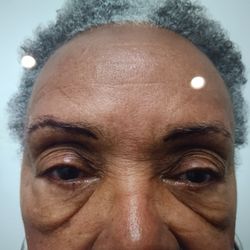 East Bay Ophthalmology - Before