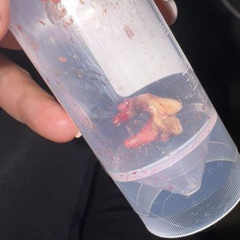 Silicon Valley Pet Clinic - The extracted tooth - Veterinarians Near Me - Santa Clara, California Silicon Valley Pet Clinic - The extracted tooth - Veterinarians Near Me - Santa Clara, California