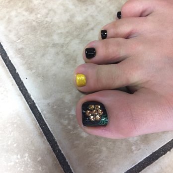 Nail And Beauty - Jeweled pineapple pedicure! - Hair Removal Near Me - Honolulu, Hawaii Nail And Beauty - Jeweled pineapple pedicure! - Hair Removal Near Me - Honolulu, Hawaii