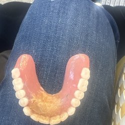 One Smile Dental - A glued denture