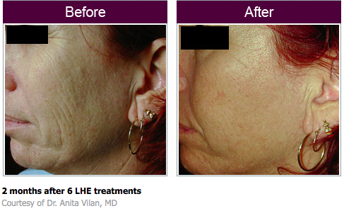 You Rejuvenated by null