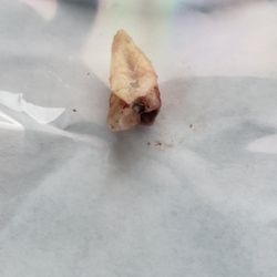 Bondurant Family Dentistry - Boy did this tooth hurt. Glad it's gone to the tooth fairy's castle