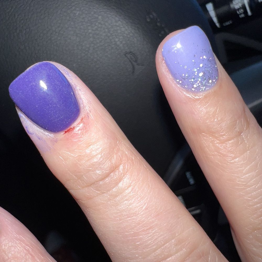 Literally every other finger had cuts. Awful!