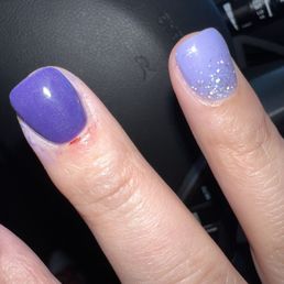 Literally every other finger had cuts. Awful!