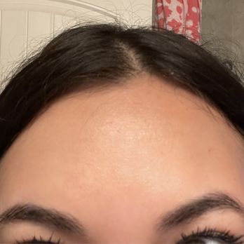 Ideal Image San Antonio - After dysport lifting eyebrows and forehead. - Medical Spas Near Me - San Antonio, Texas Ideal Image San Antonio - After dysport lifting eyebrows and forehead. - Medical Spas Near Me - San Antonio, Texas