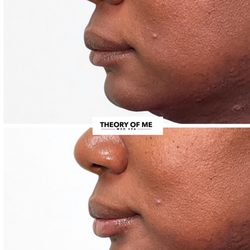 Theory Of Me Med Spa