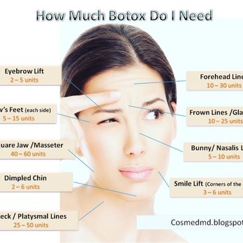 Botox By Kathleen - Medical Spas Near Me Botox By Kathleen - Medical Spas Near Me