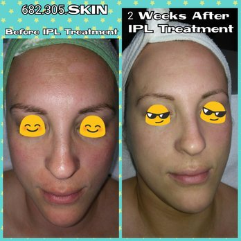 PepperAnn's Closet & Spa - Skin Care Near Me - Hurst, Texas PepperAnn's Closet & Spa - Skin Care Near Me - Hurst, Texas