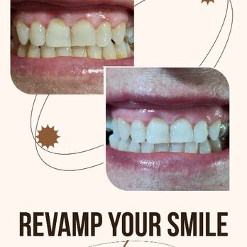 CB Cosmetic Studio - Teeth Whitening Near Me - Hollister, California CB Cosmetic Studio - Teeth Whitening Near Me - Hollister, California