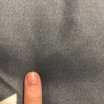 Han's Nails - After removing nail the cut from over filing is revealed. - Nail Salons Near Me - Sacramento, California