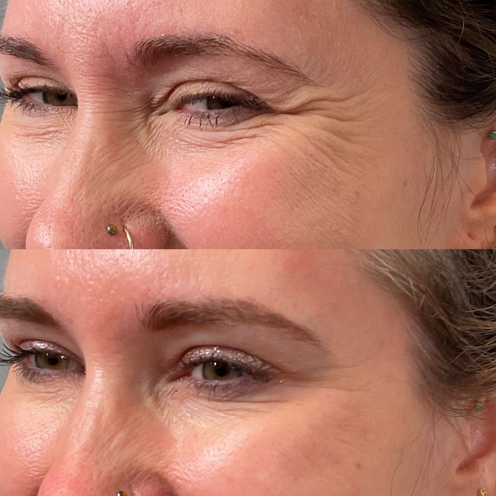 SAN DIEGO SKIN MEDSPA 18 Photos & 14 Reviews 4545 La Jolla Village Dr, San Diego, CA Yelp