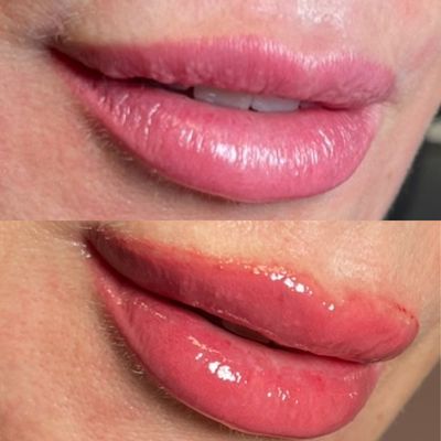 Permanent Lip Blush - Give yourself the gift of effortlessly beautiful lips 💋with Permanent Lip Blush Tattoo! Say goodbye to smudging lipstick 💄 and hello to a naturally radiant pout that lasts. ✨