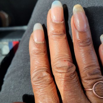 Glamour Nail Spa - It has heen one week since they messed up my nails /cuticles.... The older!! Workers may need to assist instead of doings nail.... - Nail Salons Near Me - Dublin, California Glamour Nail Spa - It has heen one week since they messed up my nails /cuticles.... The older!! Workers may need to assist instead of doings nail.... - Nail Salons Near Me - Dublin, California