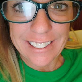 Simply Veneers - After 2 veneers, reshaping and Zoom whitening - Cosmetic Dentists Near Me - Newport Beach, California Simply Veneers - After 2 veneers, reshaping and Zoom whitening - Cosmetic Dentists Near Me - Newport Beach, California