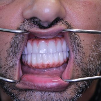 Implants 4 Life - Cosmetic Dentists Near Me - Sherman Oaks, California Implants 4 Life - Cosmetic Dentists Near Me - Sherman Oaks, California