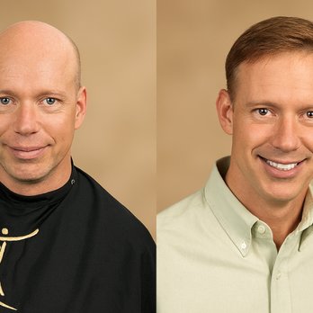 Thursday's Hair Solutions - Los Angeles hair restoration for men - Hair Loss Centers Near Me - Calabasas, California Thursday's Hair Solutions - Los Angeles hair restoration for men - Hair Loss Centers Near Me - Calabasas, California