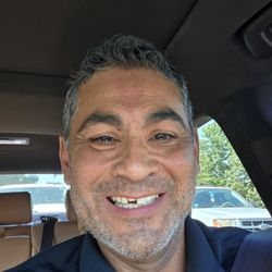 River Rock Dental Austin - Southpark Meadows - This crown has fallen out 6-8 times, has big gap in between the two front crowns where food gets stuck, tired of this ongoing problem