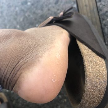 Isabella Nail Bar - Pedicure A: The heel...Just the heel... - Nail Salons Near Me - Oakland, California Isabella Nail Bar - Pedicure A: The heel...Just the heel... - Nail Salons Near Me - Oakland, California