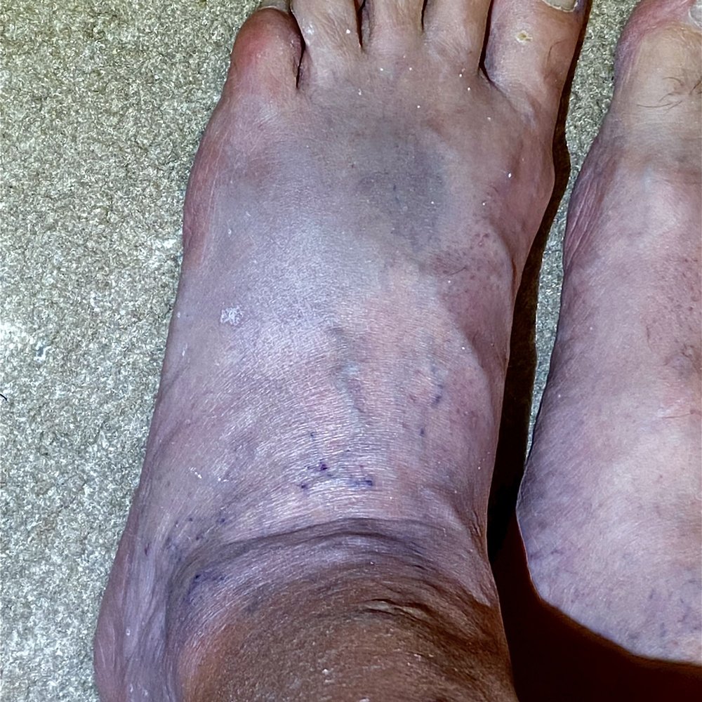 Haskell D Lyle, DPM - North Texas Foot Group - Podiatrists Near Me - MC KINNEY, Texas Haskell D Lyle, DPM - North Texas Foot Group - Podiatrists Near Me - MC KINNEY, Texas