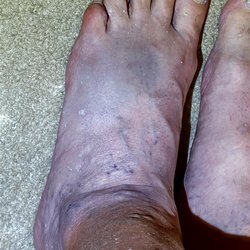 Haskell D Lyle, DPM - North Texas Foot Group
