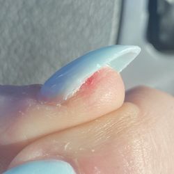 Sen Nail Lounge - Nail that was cut into the quick while removing previous manicure.