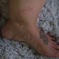 Converse Nails & Lounge - Chemical burn