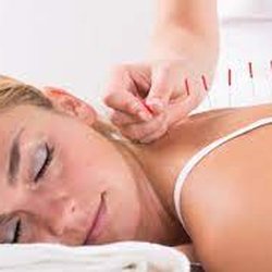 HK Acupuncture - Traditional Chinese Acupuncture