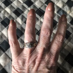 Healing Peak Regenerative Medicine - My wedding ring fits after 2 years of my hand being too swollen to wear it. This doctor is the real thing and cares about her clients.
