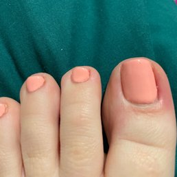 Infected toe????