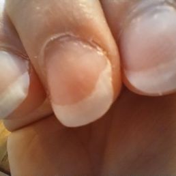Massacred my nails.