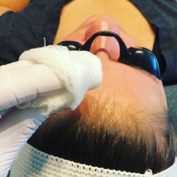 RBF Beauty - Chemical Peels