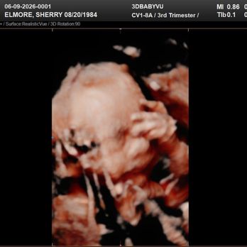 3DBabyVu - Ultrasound Imaging Centers Near Me - Pleasanton, California 3DBabyVu - Ultrasound Imaging Centers Near Me - Pleasanton, California