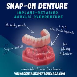 Vegas Dental Experts - Mini Dental Implant Snap-On Dentures in Las Vegas - Book A Free Consultation Today!