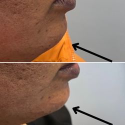 Envy Injectables & Skincare