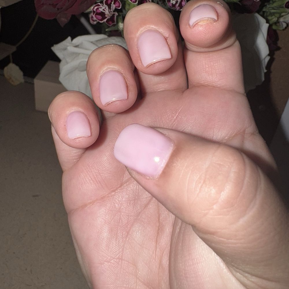 Look at the yellow part on my index finger that's the excess gel coming out my nail. Look at the yellow part on my index finger that's the excess gel coming out my nail.
