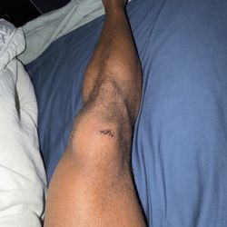 Peachtree Immediate Care - Midtown - Stitches