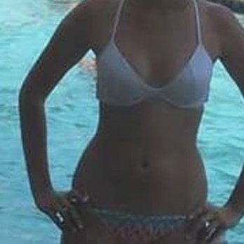 Brian Hwang ,MD - Foto del antes siendo talla 34B - Plastic Surgeons Near Me - Los Angeles, California Brian Hwang ,MD - Foto del antes siendo talla 34B - Plastic Surgeons Near Me - Los Angeles, California