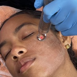 VIP Laser