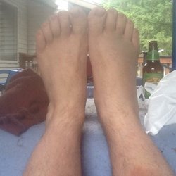 Cascade Radiology - Which foot look swollen to you?