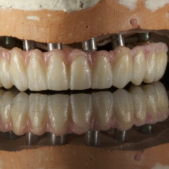 Dr. David Gomez - Some Of Our Cases - Cosmetic Dentists Near Me - Tijuana, BCN