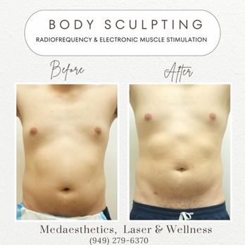 MEDAESTHETICS LASER AND WELLNESS - Updated August 2026 - 79 Photos & 23 Reviews - 10402 Westminster Ave, Garden Grove, California - Skin Care - Phone Number