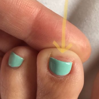 Polished Nail Bar - Cut during my pedicure due to technician being rushed to tend to other customers. - Nail Salons Near Me - Downey, California Polished Nail Bar - Cut during my pedicure due to technician being rushed to tend to other customers. - Nail Salons Near Me - Downey, California