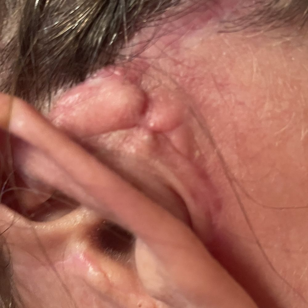 CosMed - Still have horrible pain in my scars - Cosmetic Surgeons Near Me - Tijuana, BCN