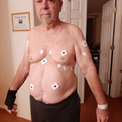 Sierra Nevada Memorial Hospital - ER would NOT remove EKG patches