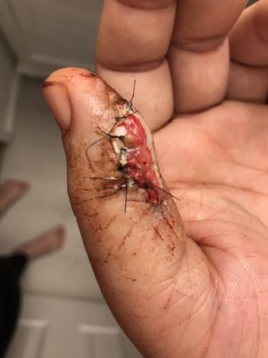 Hackensack Meridian Mountainside Medical Center by null