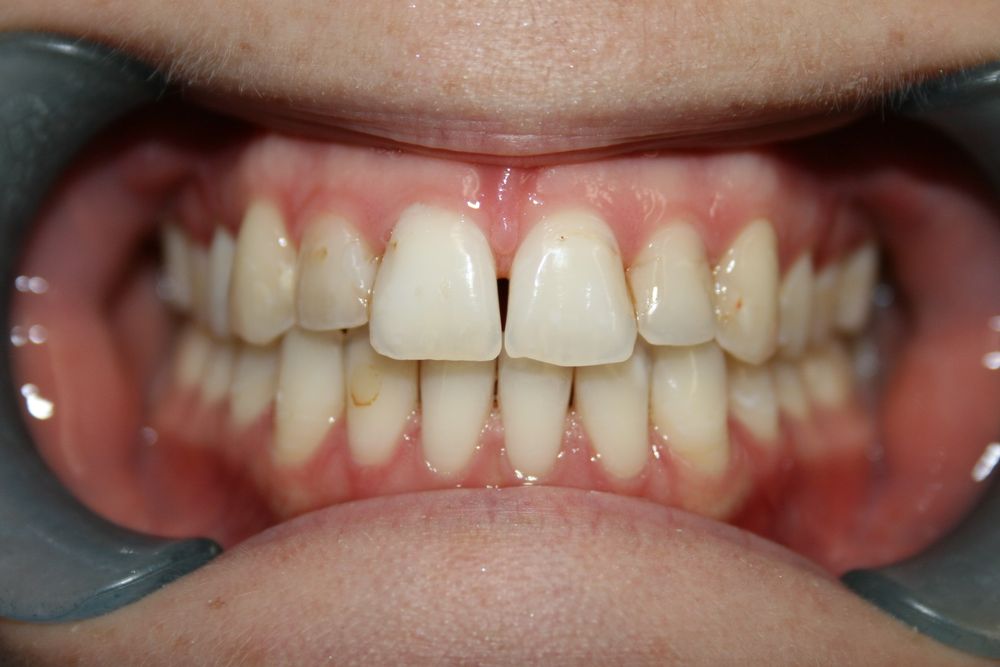 REVIVE DENTAL Updated October 2024 10 Photos 2600 Longstone Ln